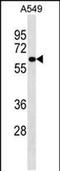 Phosphatidylinositol Glycan Anchor Biosynthesis Class S antibody, PA5-48975, Invitrogen Antibodies, Western Blot image 