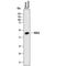 Alpha-N-Acetylgalactosaminidase antibody, PA5-47863, Invitrogen Antibodies, Western Blot image 