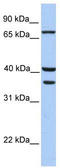 Transglutaminase 5 antibody, TA331023, Origene, Western Blot image 