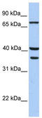 Transglutaminase-5 antibody, TA331023, Origene, Western Blot image 