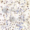 NFKB Inhibitor Beta antibody, A5777, ABclonal Technology, Immunohistochemistry paraffin image 