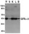 GDNF Family Receptor Alpha 3 antibody, TA305954, Origene, Western Blot image 