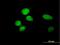 Zinc Finger And BTB Domain Containing 8A antibody, H00653121-B01P, Novus Biologicals, Immunofluorescence image 