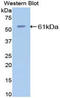 Estrogen Receptor 2 antibody, LS-C301120, Lifespan Biosciences, Western Blot image 