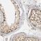 Centriolar Coiled-Coil Protein 110 antibody, FNab01915, FineTest, Immunohistochemistry paraffin image 