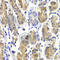 SHC Adaptor Protein 1 antibody, A7725, ABclonal Technology, Immunohistochemistry paraffin image 