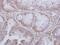 Serine/threonine-protein kinase 24 antibody, GTX113371, GeneTex, Immunohistochemistry paraffin image 