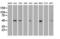 Polo Like Kinase 1 antibody, LS-C784221, Lifespan Biosciences, Western Blot image 