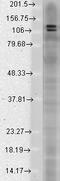 DLG Associated Protein 1 antibody, LS-C230910, Lifespan Biosciences, Western Blot image 