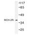 Melanin Concentrating Hormone Receptor 2 antibody, AP01217PU-N, Origene, Western Blot image 