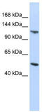 HECT And RLD Domain Containing E3 Ubiquitin Protein Ligase 5 antibody, TA329859, Origene, Western Blot image 