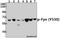 FYN Proto-Oncogene, Src Family Tyrosine Kinase antibody, A00684Y530-1, Boster Biological Technology, Western Blot image 