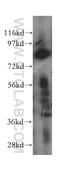 Integrator Complex Subunit 10 antibody, 15271-1-AP, Proteintech Group, Western Blot image 