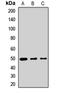 ISL LIM Homeobox 1 antibody, LS-C668483, Lifespan Biosciences, Western Blot image 