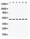 Eukaryotic Translation Initiation Factor 4A2 antibody, PB9758, Boster Biological Technology, Western Blot image 