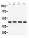 Actin Gamma 1 antibody, PA1324-1, Boster Biological Technology, Western Blot image 