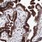 VPS8 Subunit Of CORVET Complex antibody, HPA036871, Atlas Antibodies, Immunohistochemistry frozen image 