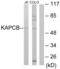 cAMP-dependent protein kinase catalytic subunit beta antibody, abx013432, Abbexa, Western Blot image 