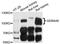 Semaphorin 4B antibody, STJ113673, St John