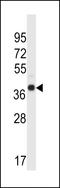 WD Repeat Domain 89 antibody, 57-034, ProSci, Western Blot image 