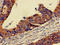 Period Circadian Regulator 3 antibody, LS-C678986, Lifespan Biosciences, Immunohistochemistry paraffin image 