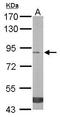 Trehalase antibody, TA308997, Origene, Western Blot image 