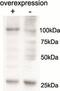 Alanyl-TRNA Synthetase 2, Mitochondrial antibody, MBS422922, MyBioSource, Western Blot image 