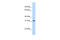 Nucleolar Protein Interacting With The FHA Domain Of MKI67 antibody, 29-482, ProSci, Western Blot image 