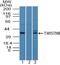 TWIST Neighbor antibody, PA5-23473, Invitrogen Antibodies, Western Blot image 