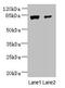 WD Repeat Domain 49 antibody, CSB-PA810271LA01HU, Cusabio, Western Blot image 