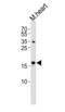 Uncharacterized protein KIAA0802 antibody, orb314066, Biorbyt, Western Blot image 