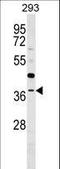 TRNA Methyltransferase 10B antibody, LS-C158840, Lifespan Biosciences, Western Blot image 