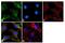 TIMP Metallopeptidase Inhibitor 1 antibody, MA1-773, Invitrogen Antibodies, Immunofluorescence image 