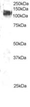 Cbl Proto-Oncogene antibody, LS-C20138, Lifespan Biosciences, Western Blot image 