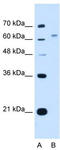 WSC Domain Containing 2 antibody, TA341947, Origene, Western Blot image 