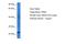 Interferon Alpha 2 antibody, A03044, Boster Biological Technology, Western Blot image 