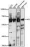 Adenylate Kinase 5 antibody, 16-041, ProSci, Western Blot image 