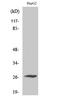 Sodium Voltage-Gated Channel Beta Subunit 4 antibody, A06453, Boster Biological Technology, Western Blot image 