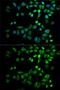 Proteasome 26S Subunit, Non-ATPase 10 antibody, GTX32820, GeneTex, Immunocytochemistry image 