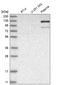 Adenosine Monophosphate Deaminase 2 antibody, HPA027137, Atlas Antibodies, Western Blot image 