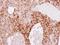 Retinol Binding Protein 4 antibody, PA5-29173, Invitrogen Antibodies, Immunohistochemistry paraffin image 