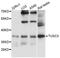 Tumor Suppressor Candidate 3 antibody, LS-C747667, Lifespan Biosciences, Western Blot image 