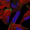 Oxysterol Binding Protein Like 6 antibody, HPA032131, Atlas Antibodies, Immunofluorescence image 