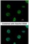 Nucleoside-Triphosphatase, Cancer-Related antibody, PA5-21930, Invitrogen Antibodies, Immunofluorescence image 