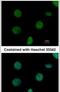 Nucleoside-Triphosphatase, Cancer-Related antibody, PA5-21930, Invitrogen Antibodies, Immunofluorescence image 