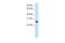 Ribosomal Oxygenase 2 antibody, A00783, Boster Biological Technology, Western Blot image 