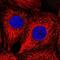 TBC1 Domain Family Member 2B antibody, PA5-61676, Invitrogen Antibodies, Immunofluorescence image 