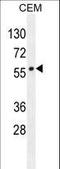 Lipase C, Hepatic Type antibody, LS-C165792, Lifespan Biosciences, Western Blot image 