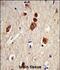 ELAV-like protein 1 antibody, A00736, Boster Biological Technology, Immunohistochemistry paraffin image 