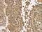 Transglutaminase 6 antibody, PA5-51337, Invitrogen Antibodies, Immunohistochemistry paraffin image 